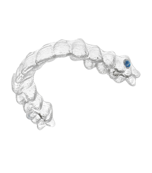 Clear aligners for teens in Hawthorn