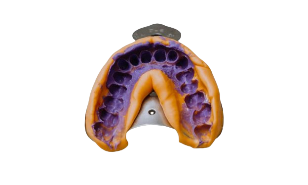 Analog impression of a mouth