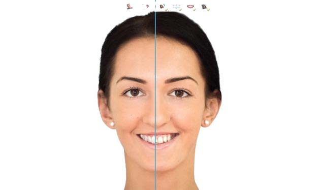 Digital smile design software showing orthodontic treatment simulation