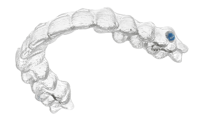 Diagram image of a clear aligner