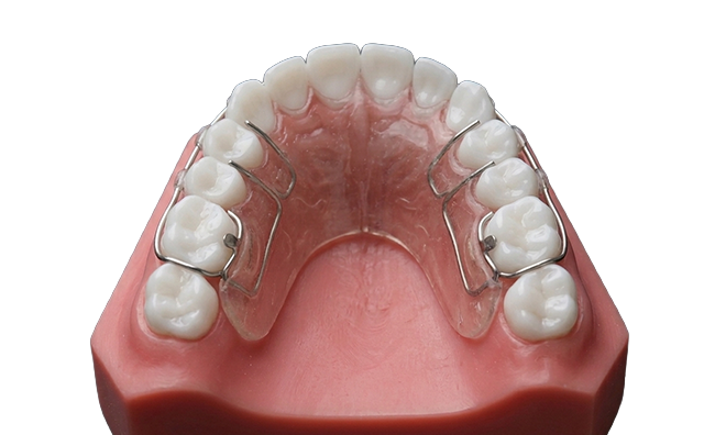 Diagram showing a Hawley style retainer sitting in the mouth