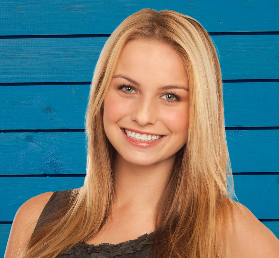 Young girl smiling with clear ceramic braces