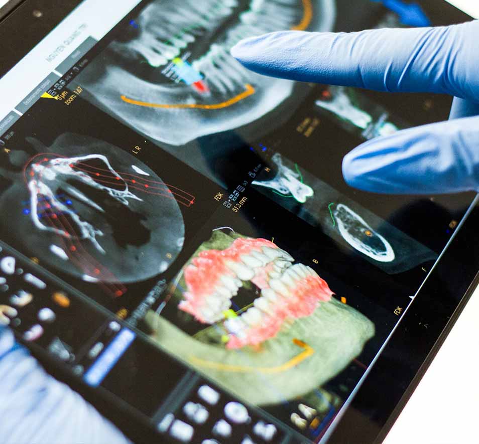 X-rays used for orthodontic surgical planning