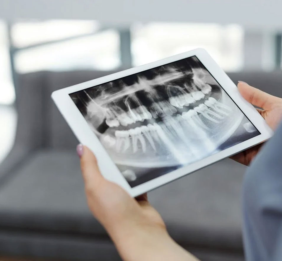 Picute of someone holding a tablet device with an OPG xray